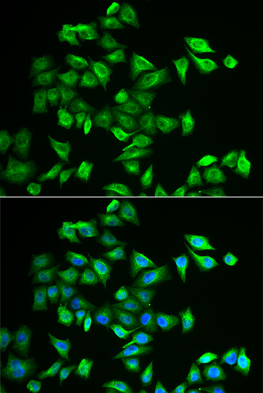 Immunofluorescence analysis of A549 cells using POMGNT2 Polyclonal Antibody