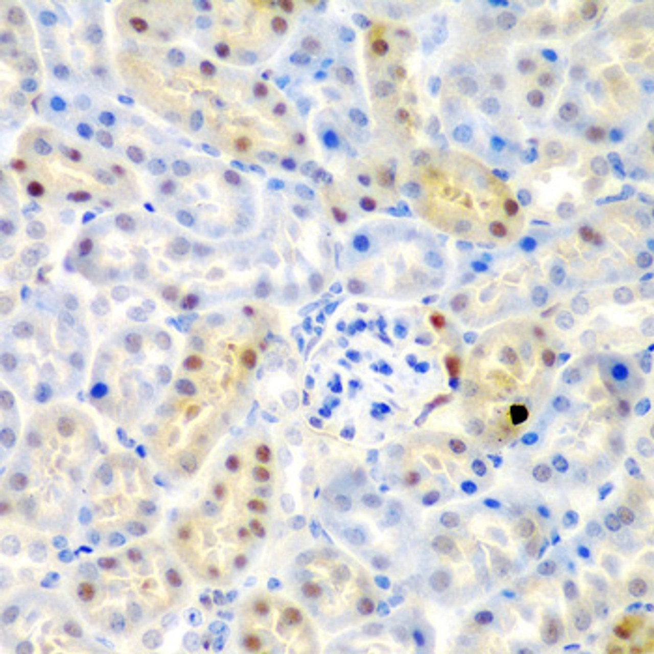 Immunohistochemistry of paraffin-embedded Mouse kidney using ADAD1 Polyclonal Antibody at dilution of  1:200 (40x lens).