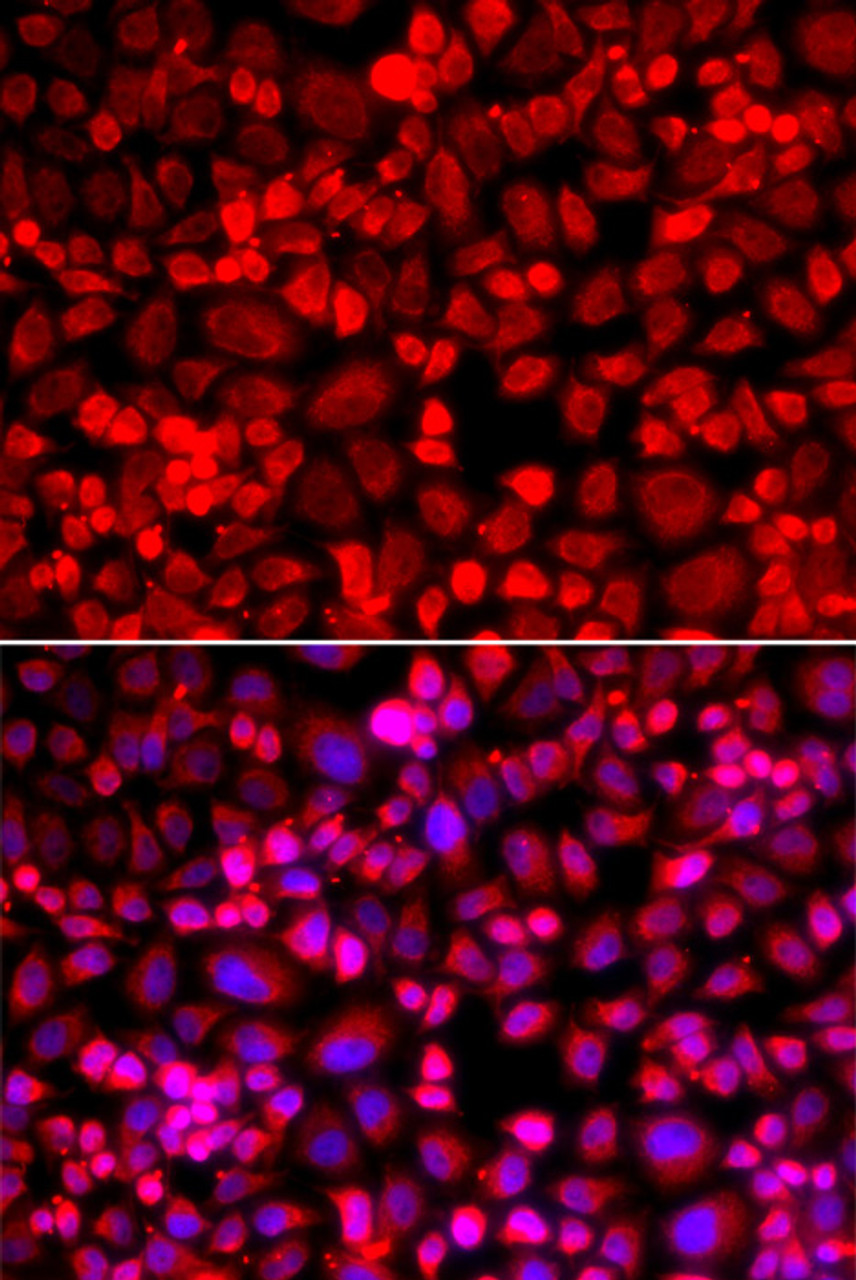 Immunofluorescence analysis of A549 cells using ANLN Polyclonal Antibody