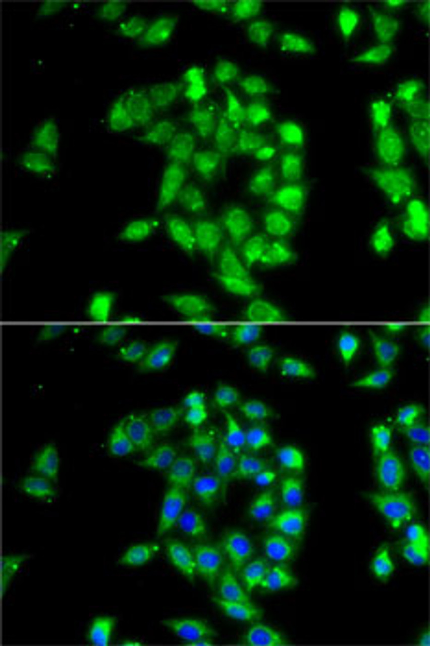 Immunofluorescence analysis of MCF7 cells using ANTXR1 Polyclonal Antibody