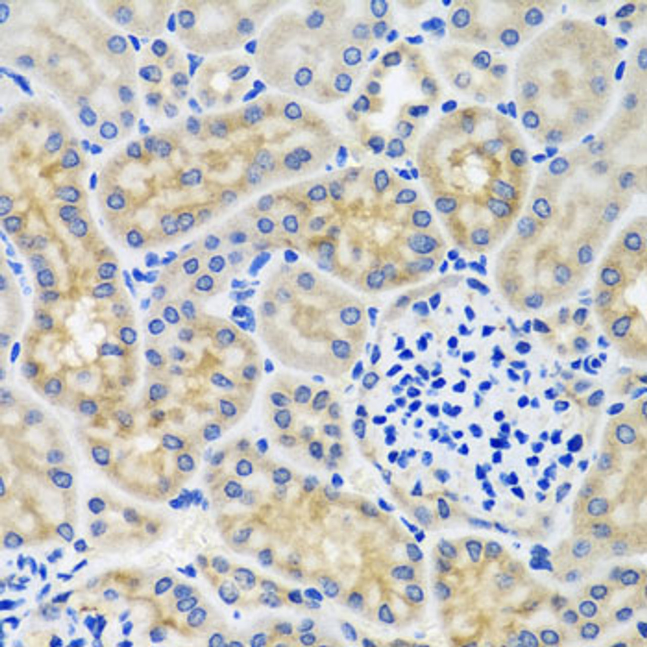 Immunohistochemistry of paraffin-embedded Mouse kidney using ANTXR2 Polyclonal Antibody at dilution of  1:100 (40x lens).