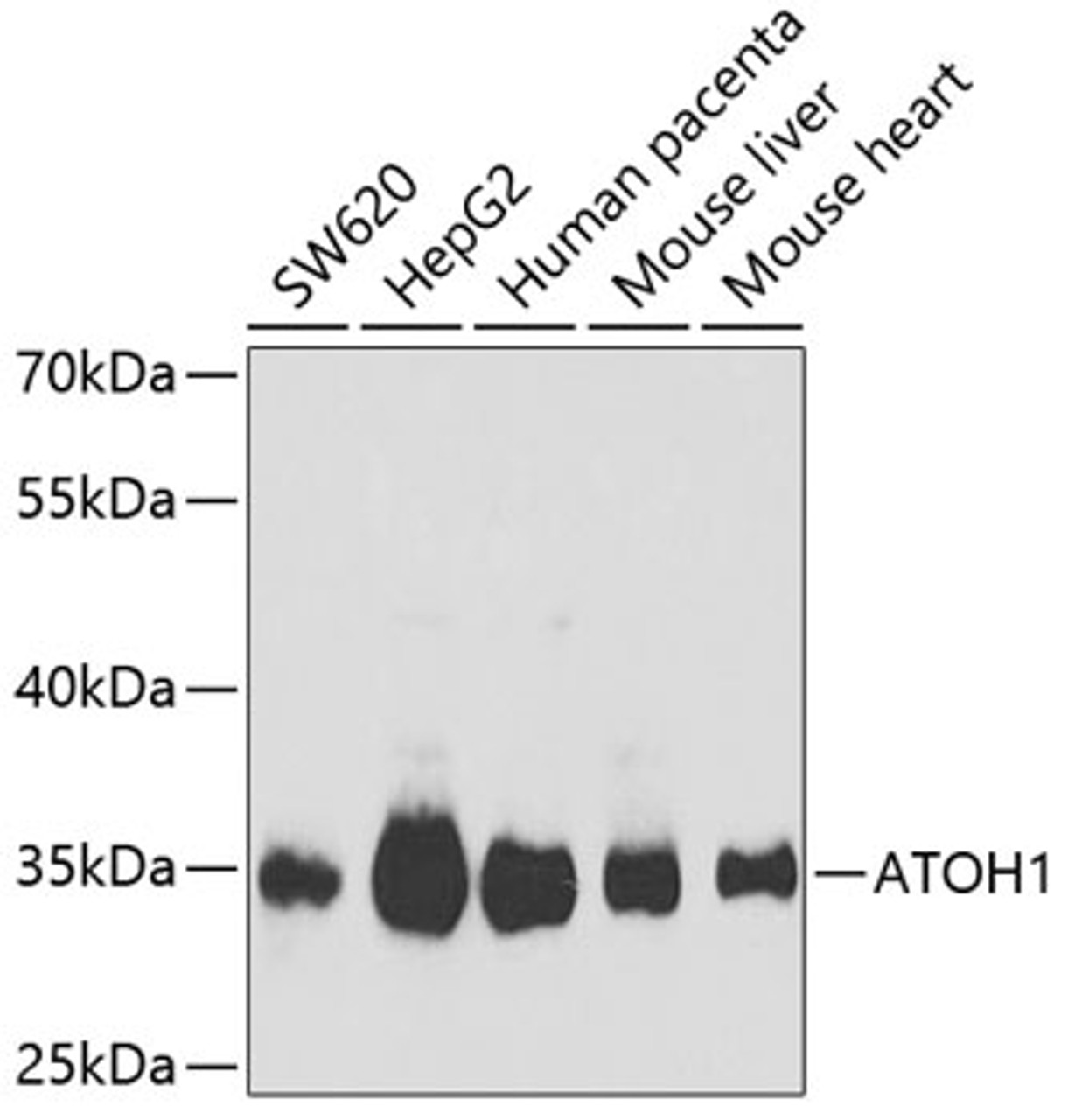 Western blot analysis of extracts of various cell lines using ATOH1 Polyclonal Antibody at dilution of 1:1000.