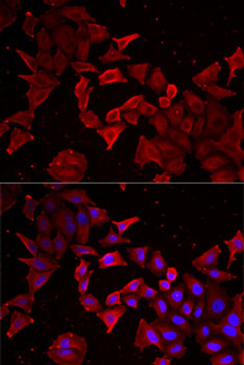 Immunofluorescence analysis of MCF7 cells using Caspase-14 Polyclonal Antibody