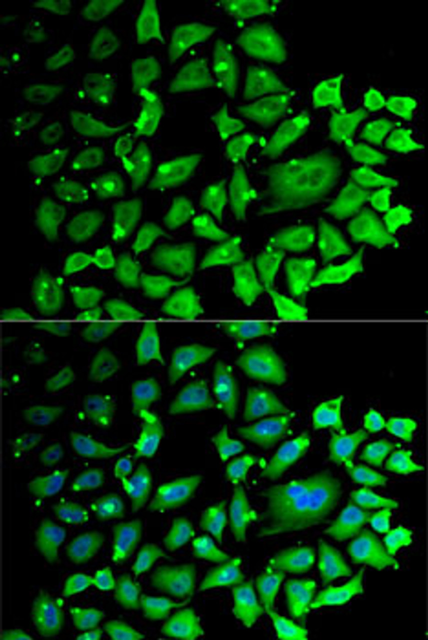Immunofluorescence analysis of MCF7 cells using CCNC Polyclonal Antibody