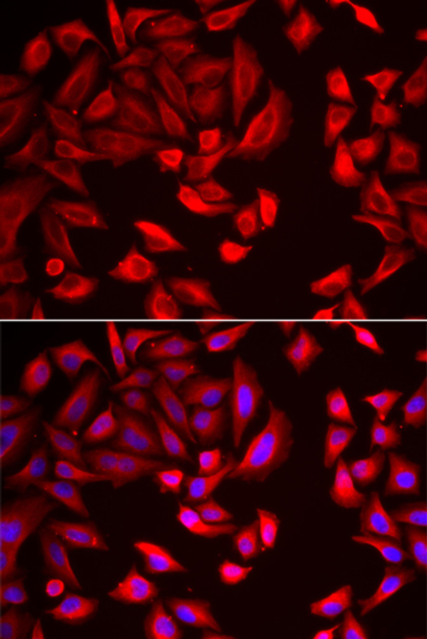Immunofluorescence analysis of HeLa cells using CCT2 Polyclonal Antibody