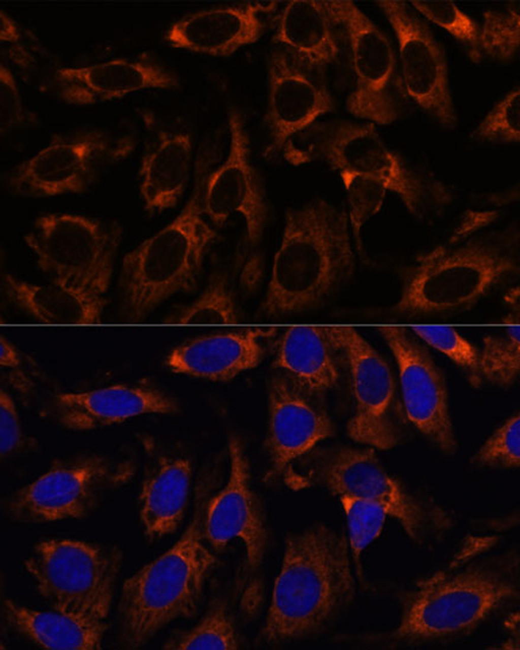 Immunofluorescence analysis of U-2 OS cells using CCT3 Polyclonal Antibody at dilution of  1:100. Blue: DAPI for nuclear staining.