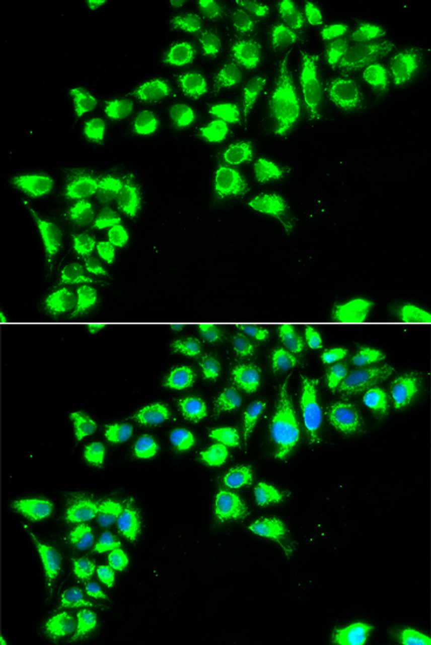 Immunofluorescence analysis of HeLa cells using CLDN2 Polyclonal Antibody
