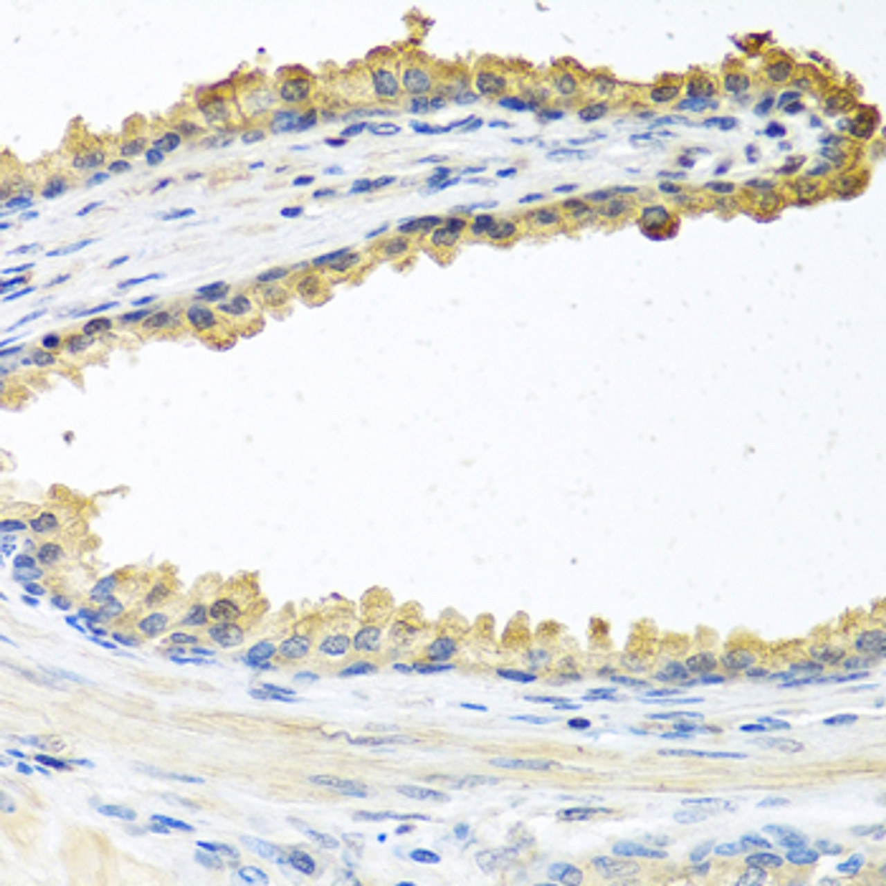 Immunohistochemistry of paraffin-embedded Human prostate using COCH Polyclonal Antibody at dilution of  1:100 (40x lens).