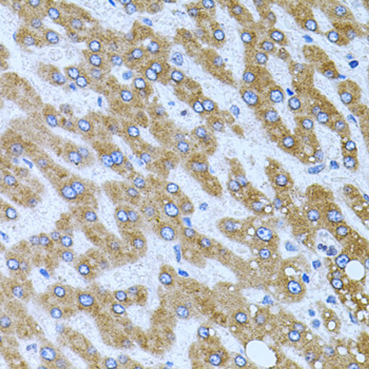 Immunohistochemistry of paraffin-embedded Human liver damage using CPM Polyclonal Antibody at dilution of  1:100 (40x lens).