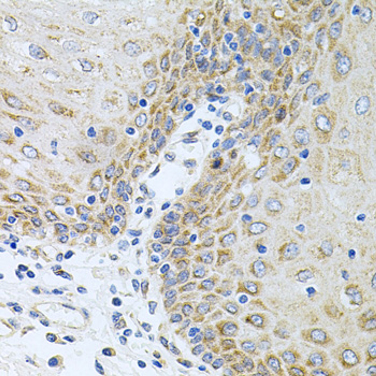 Immunohistochemistry of paraffin-embedded Human esophagus using CPM Polyclonal Antibody at dilution of  1:100 (40x lens).