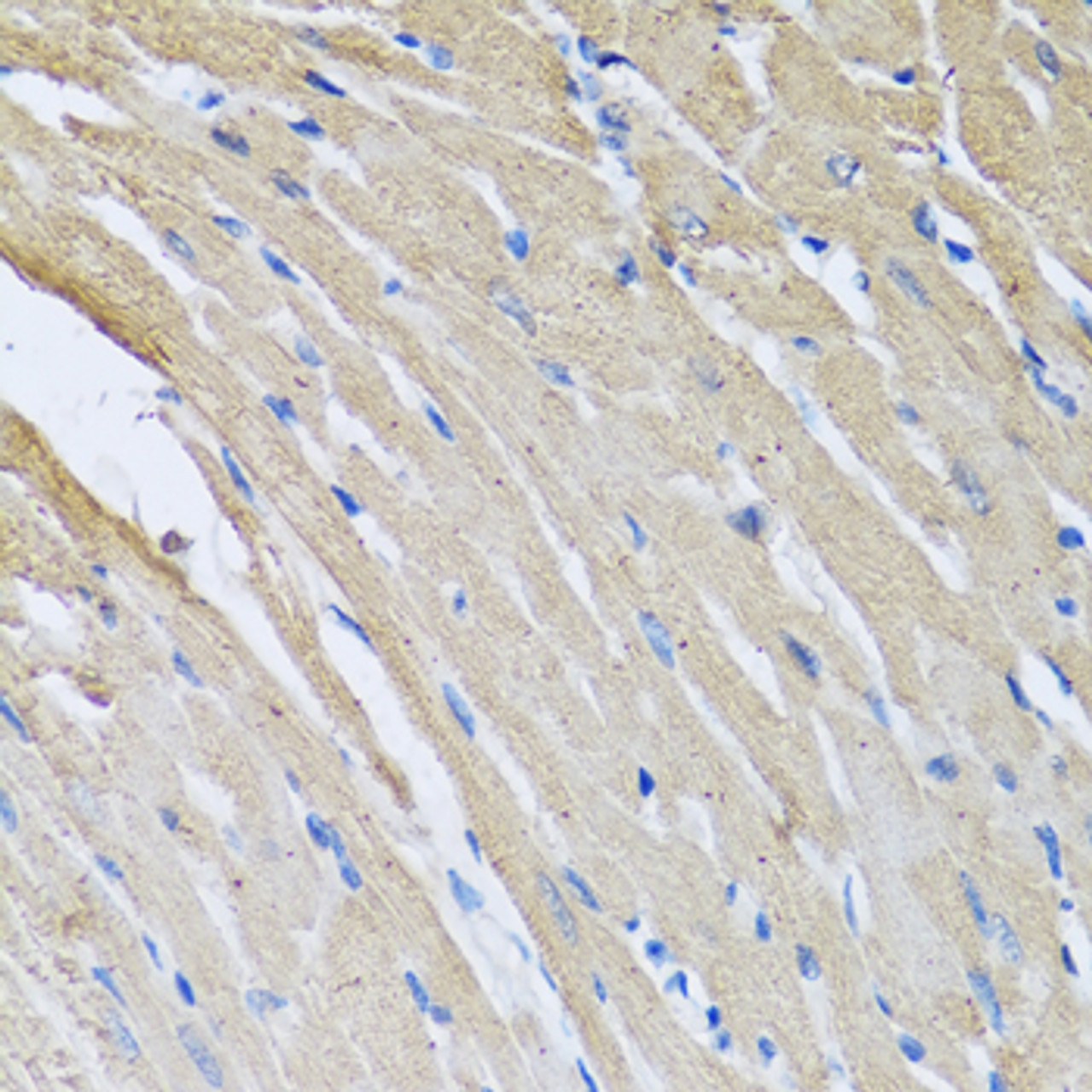 Immunohistochemistry of paraffin-embedded Rat heart using CRHBP Polyclonal Antibody at dilution of  1:100 (40x lens).
