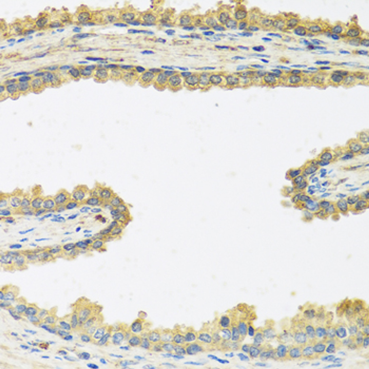 Immunohistochemistry of paraffin-embedded Human prostate using CRHBP Polyclonal Antibody at dilution of  1:100 (40x lens).