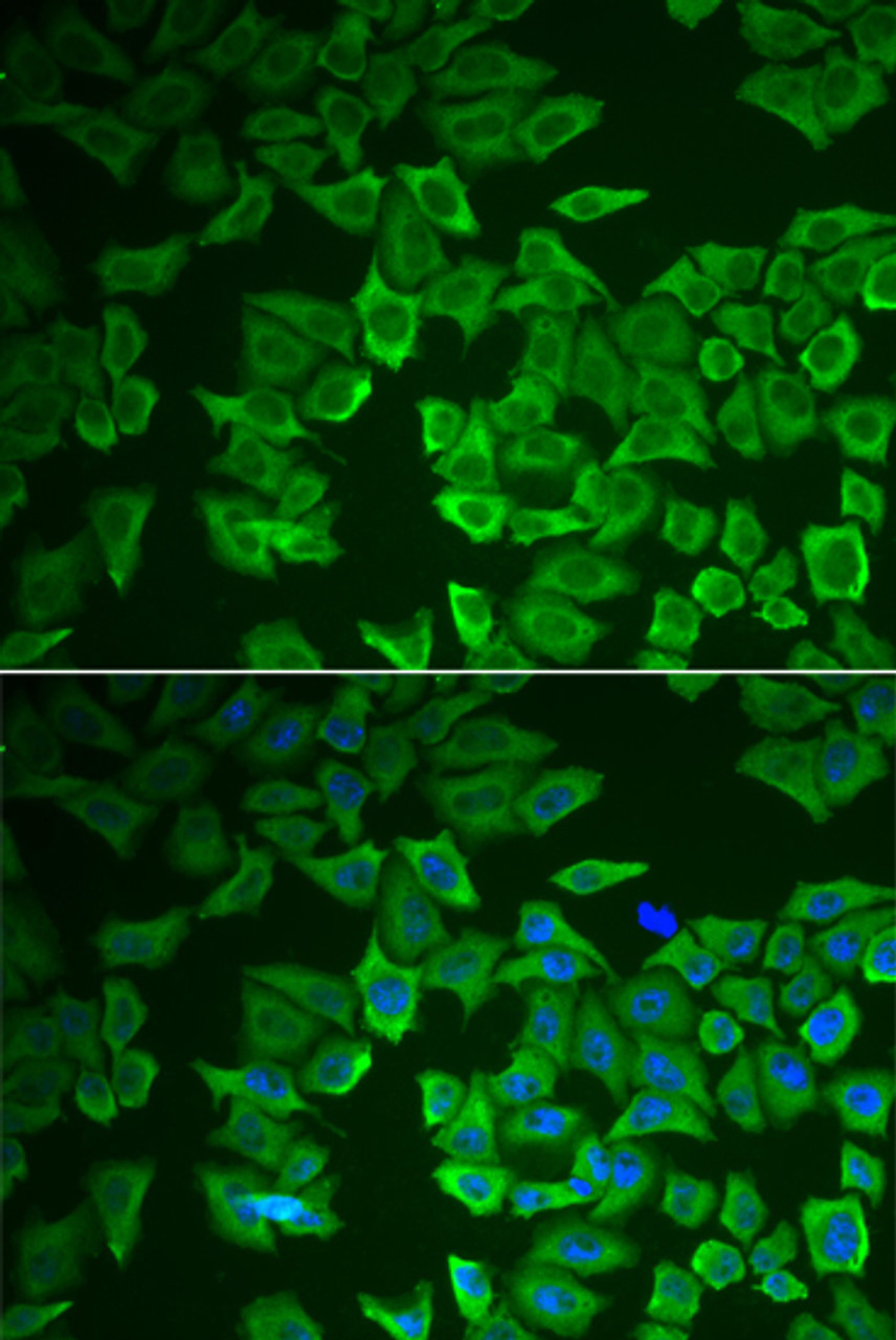 Immunofluorescence analysis of HeLa cells using CRHBP Polyclonal Antibody