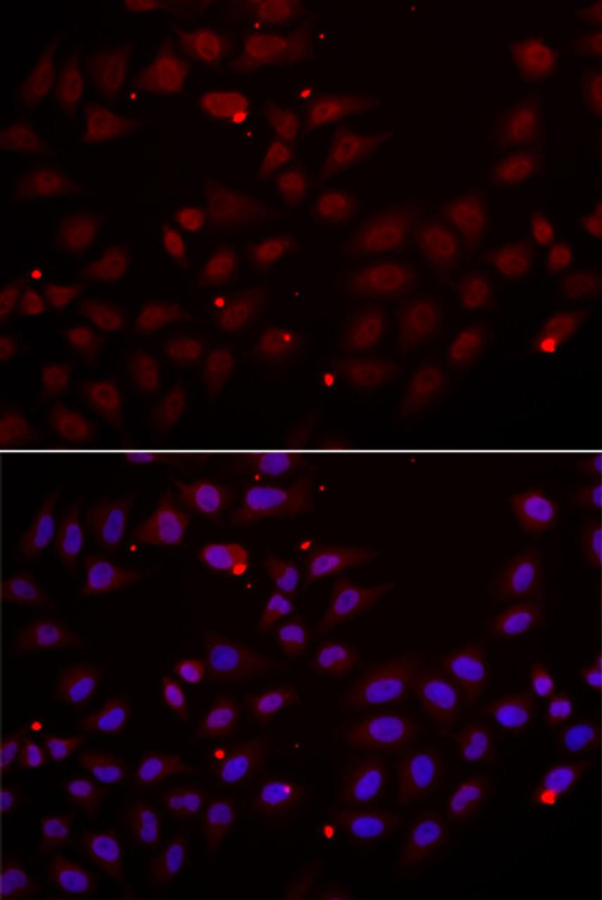 Immunofluorescence analysis of HeLa cells using CST2 Polyclonal Antibody