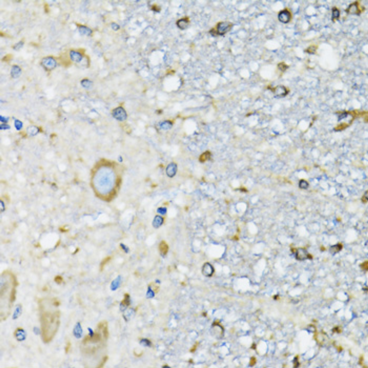 Immunohistochemistry of paraffin-embedded Mouse spinal cord using DARS Polyclonal Antibody at dilution of  1:100 (40x lens).