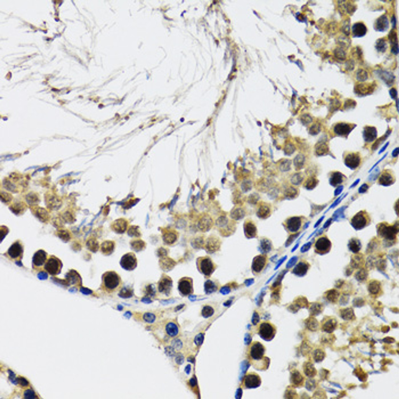 Immunohistochemistry of paraffin-embedded Rat testis using DDX41 Polyclonal Antibody at dilution of  1:100 (40x lens).