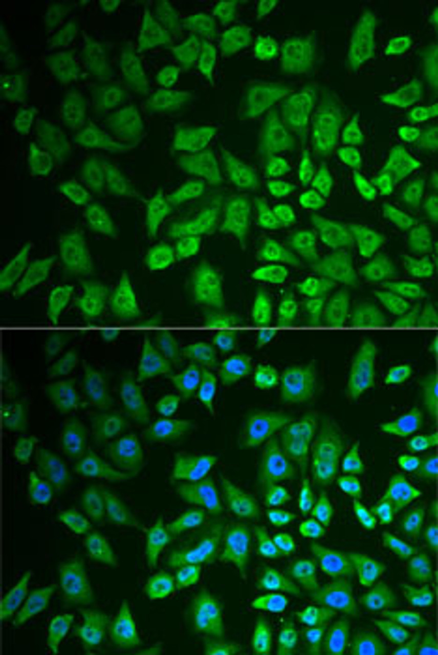 Immunofluorescence analysis of U2OS cells using DDX41 Polyclonal Antibody