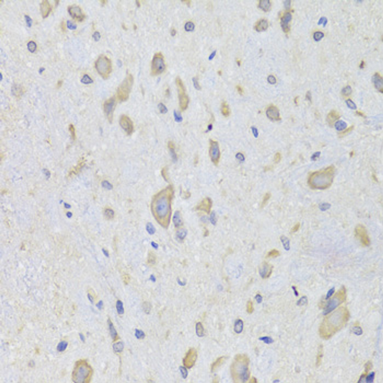 Immunohistochemistry of paraffin-embedded Rat spinal cord using EEF1B2 Polyclonal Antibody at dilution of  1:100 (40x lens).