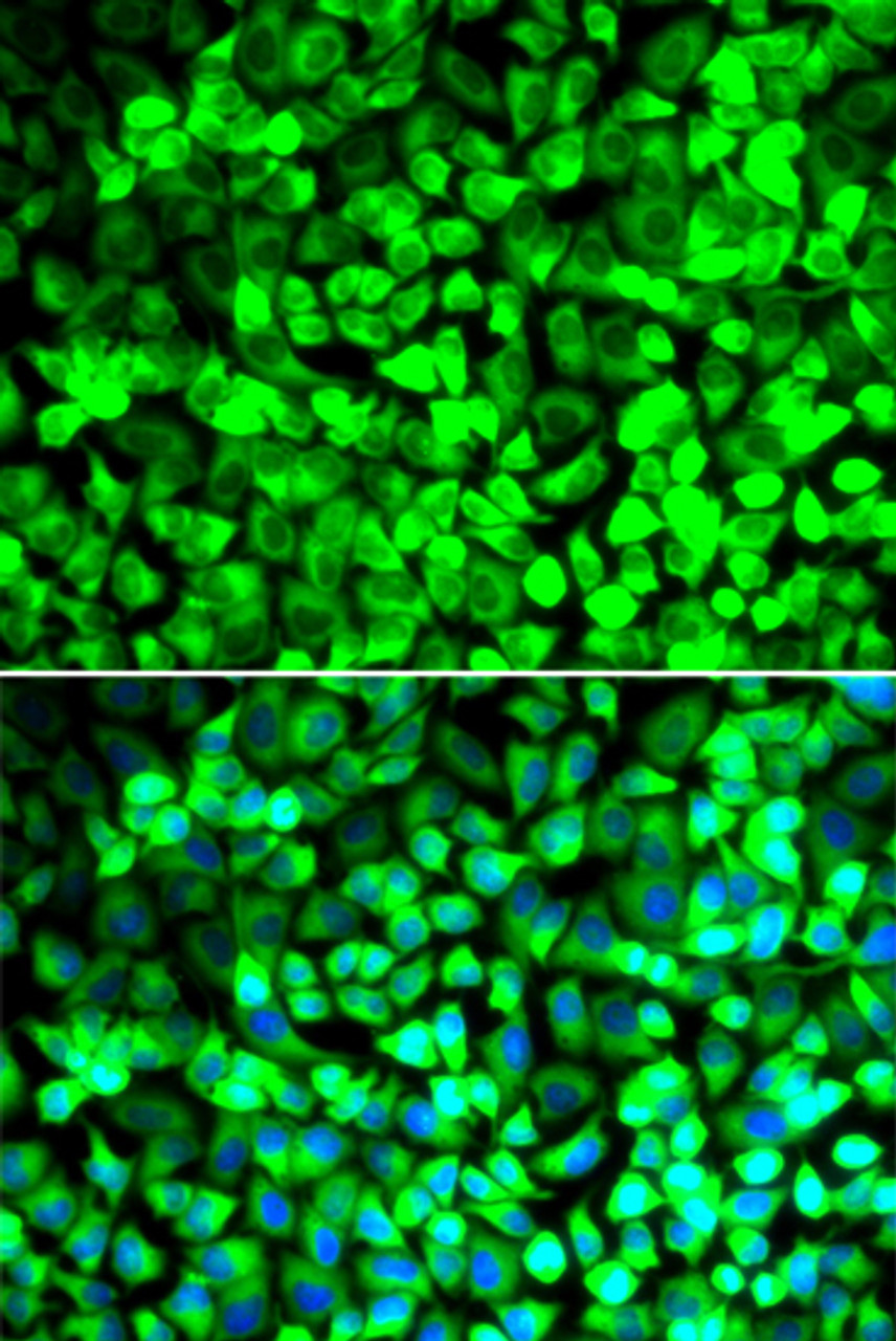 Immunofluorescence analysis of U2OS cells using EIF5 Polyclonal Antibody