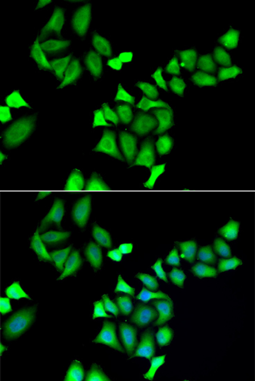 Immunofluorescence analysis of A549 cells using GALE Polyclonal Antibody