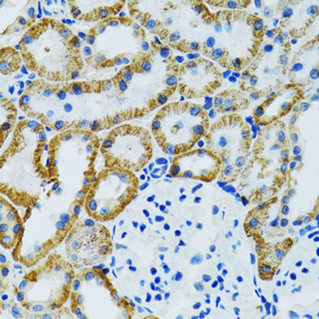 Immunohistochemistry of paraffin-embedded Mouse kidney using GDAP1 Polyclonal Antibody at dilution of  1:100 (40x lens).