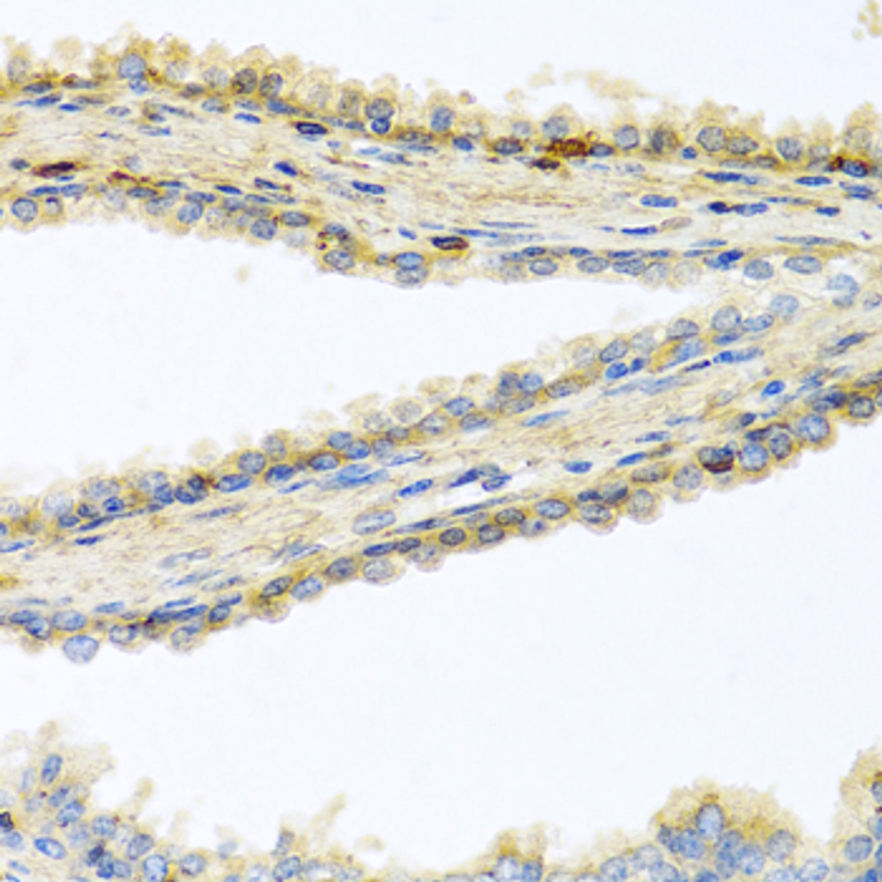 Immunohistochemistry of paraffin-embedded Human prostate using GPLD1 Polyclonal Antibody at dilution of  1:100 (40x lens).
