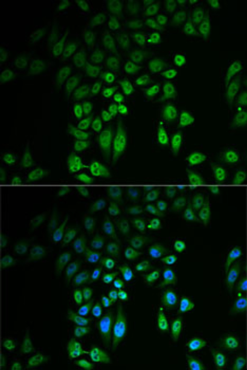Immunofluorescence analysis of U2OS cells using GPLD1 Polyclonal Antibody
