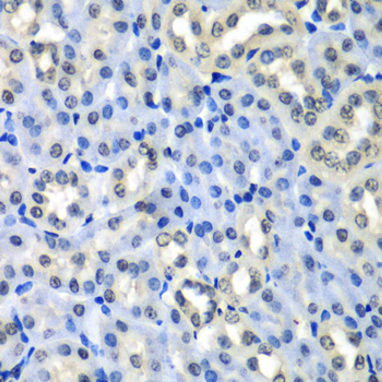 Immunohistochemistry of paraffin-embedded Mouse kidney using Histone H2A.Z Polyclonal Antibody at dilution of  1:100 (40x lens).
