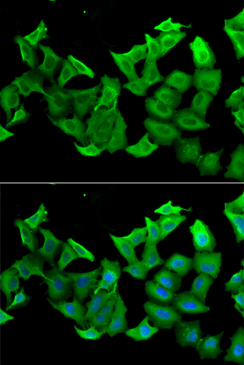 Immunofluorescence analysis of A549 cells using HAGH Polyclonal Antibody