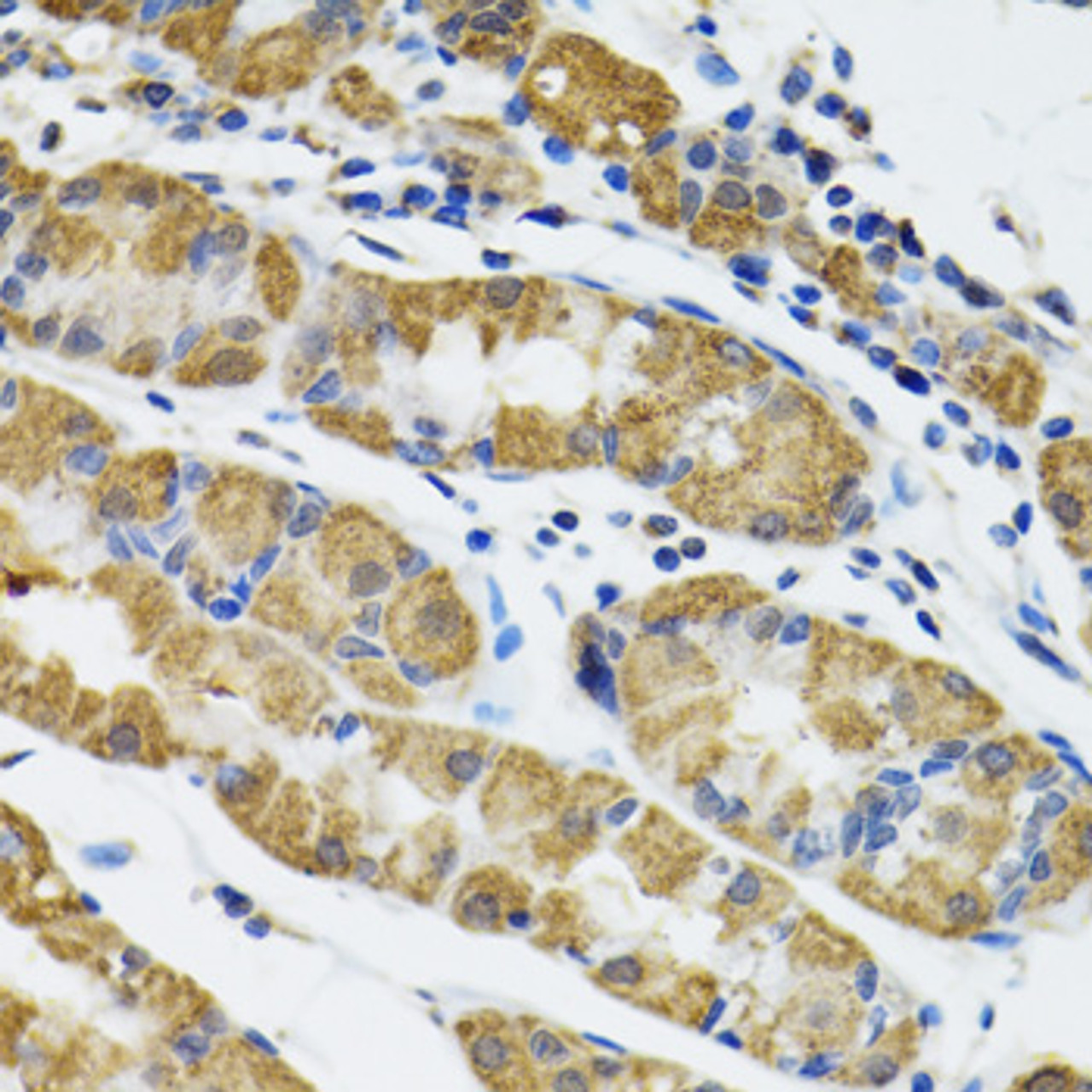 Immunohistochemistry of paraffin-embedded Human stomach using HAPLN1 Polyclonal Antibody at dilution of  1:100 (40x lens).