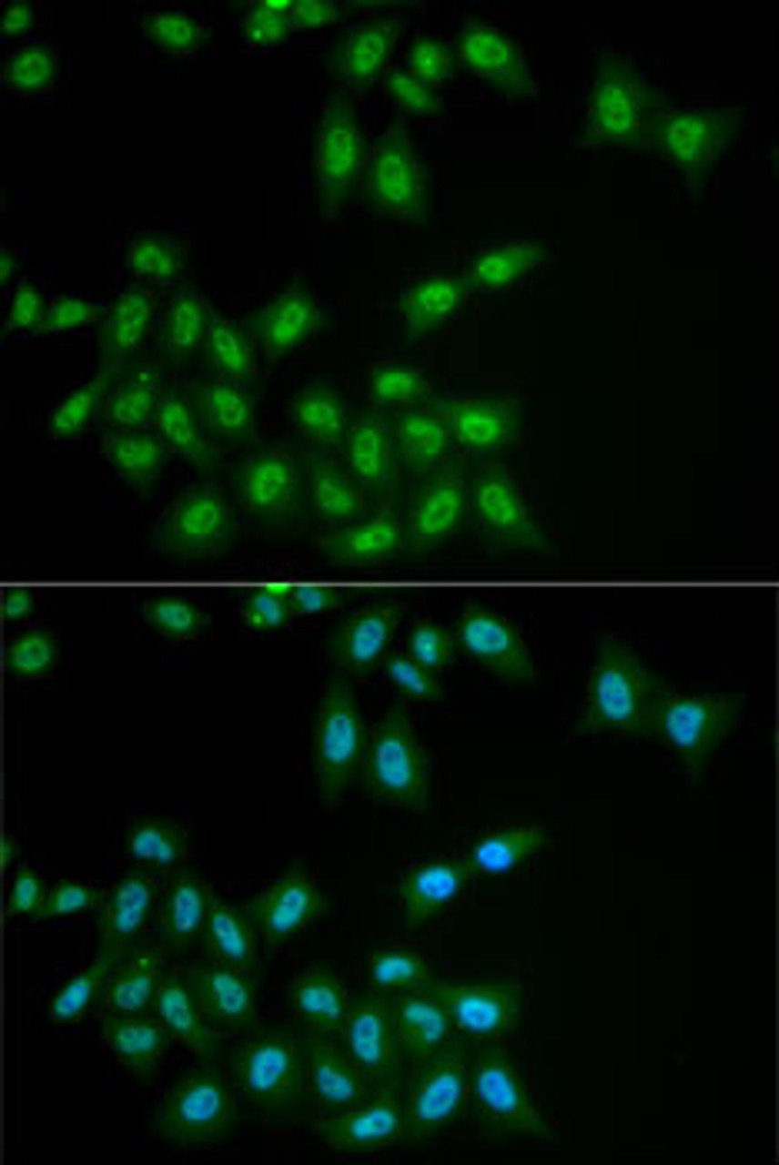 Immunofluorescence analysis of MCF7 cells using HPS1 Polyclonal Antibody