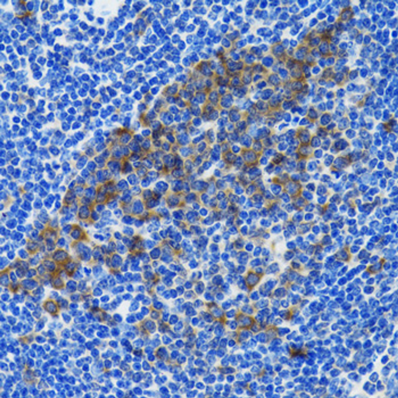 Immunohistochemistry of paraffin-embedded Rat spleen using HSPH1 Polyclonal Antibody at dilution of  1:100 (40x lens).