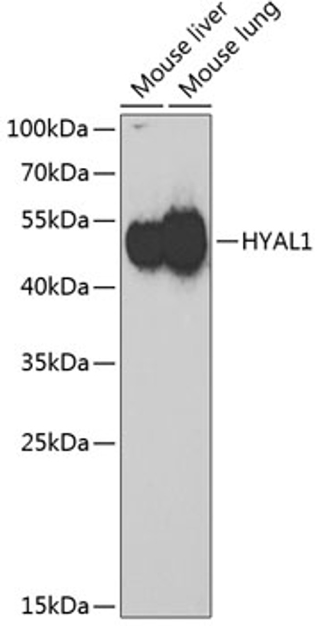 Western blot analysis of extracts of various cell lines using HYAL1 Polyclonal Antibody at dilution of 1:1000.