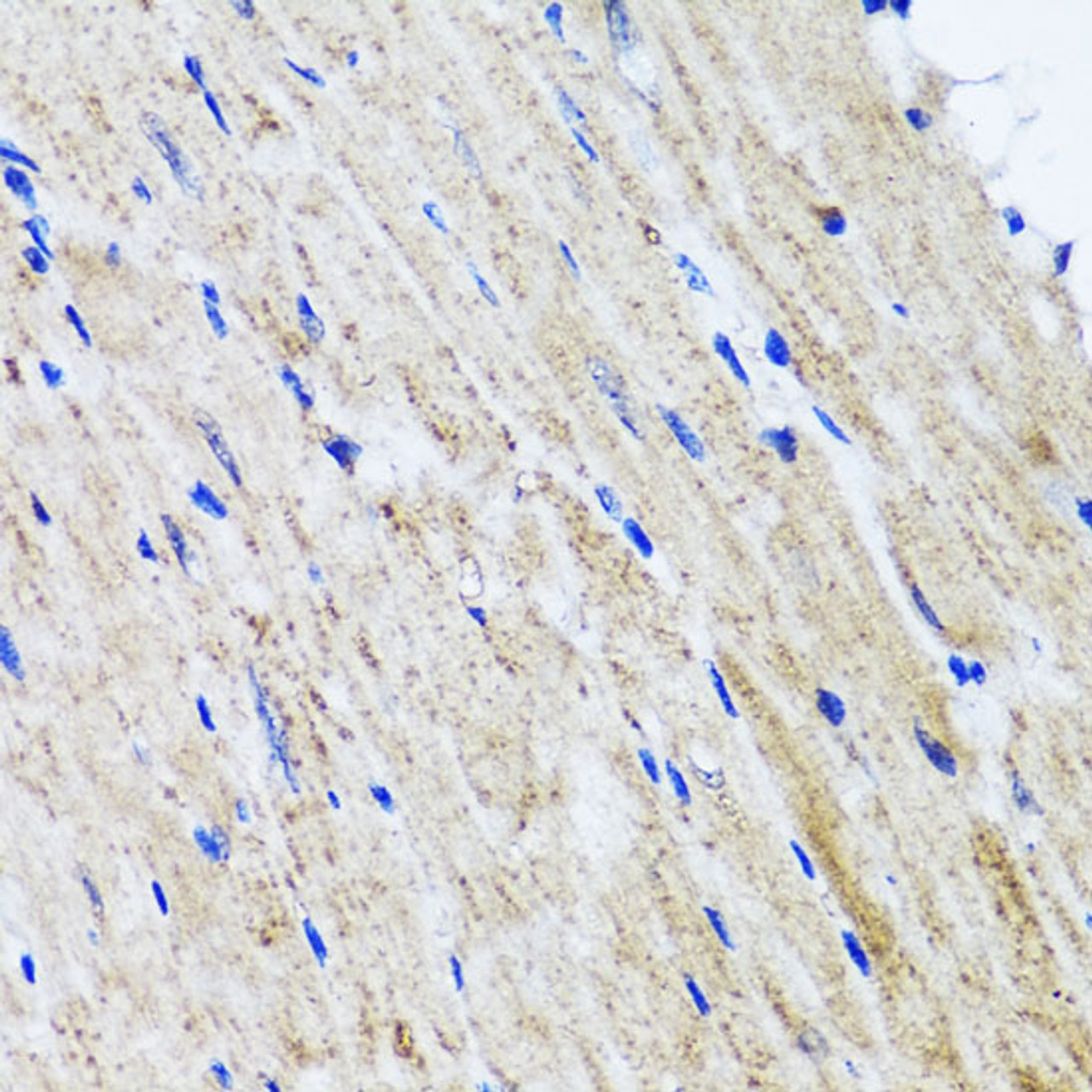 Immunohistochemistry of paraffin-embedded Mouse heart using HYAL1 Polyclonal Antibody at dilution of  1:100 (40x lens).