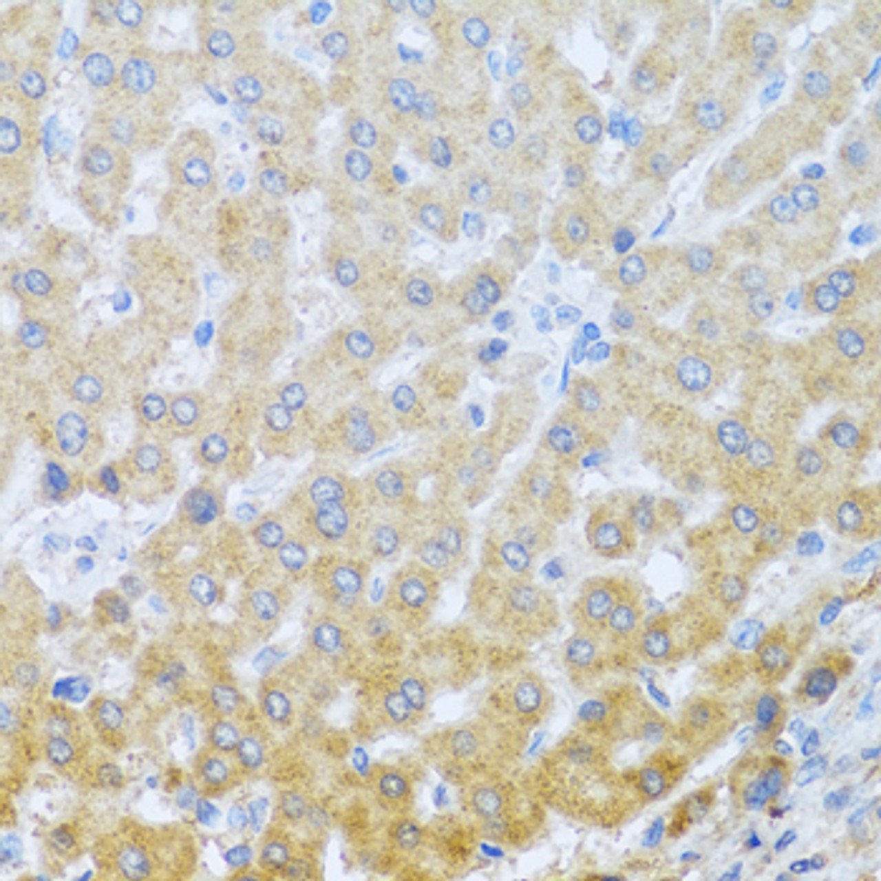 Immunohistochemistry of paraffin-embedded Human liver using IL20 Polyclonal Antibody at dilution of  1:100 (40x lens).