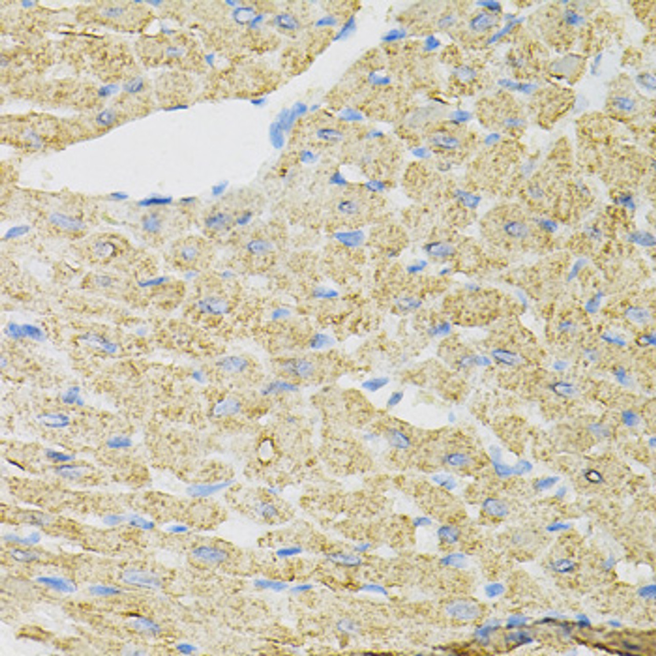 Immunohistochemistry of paraffin-embedded Mouse heart using INPP5J Polyclonal Antibody at dilution of  1:100 (40x lens).