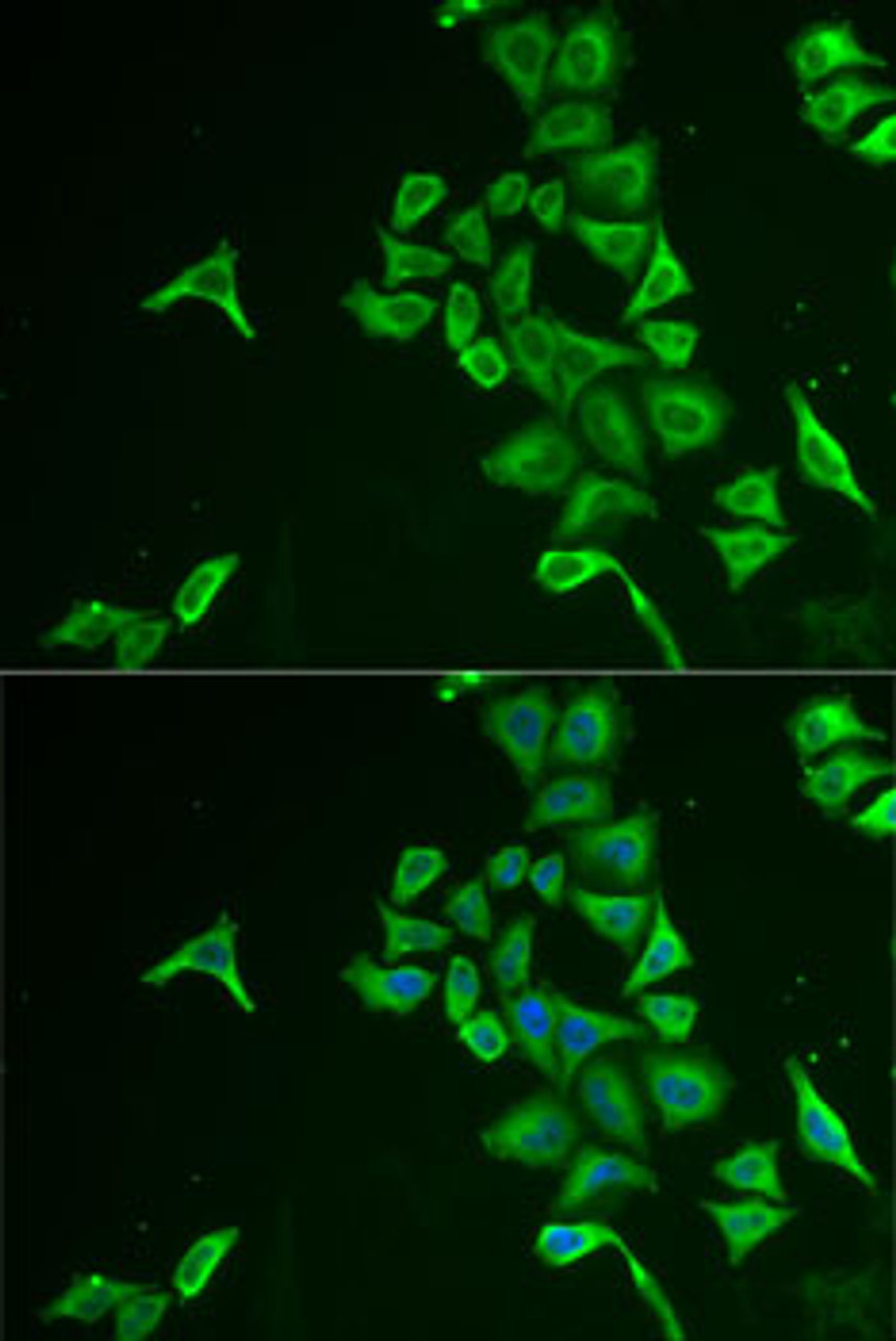 Immunofluorescence analysis of U2OS cells using INPP5J Polyclonal Antibody