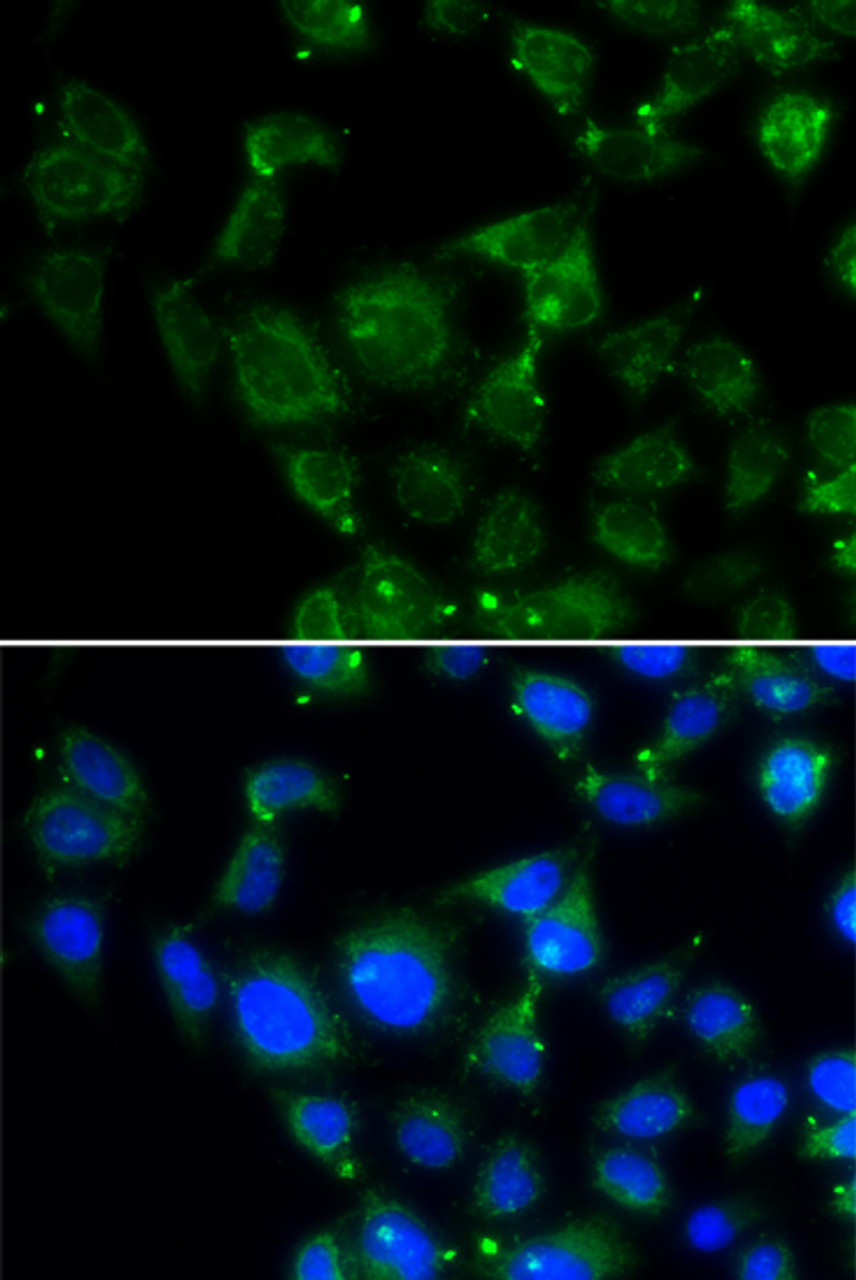 Immunofluorescence analysis of HeLa cells using MAPRE2 Polyclonal Antibody