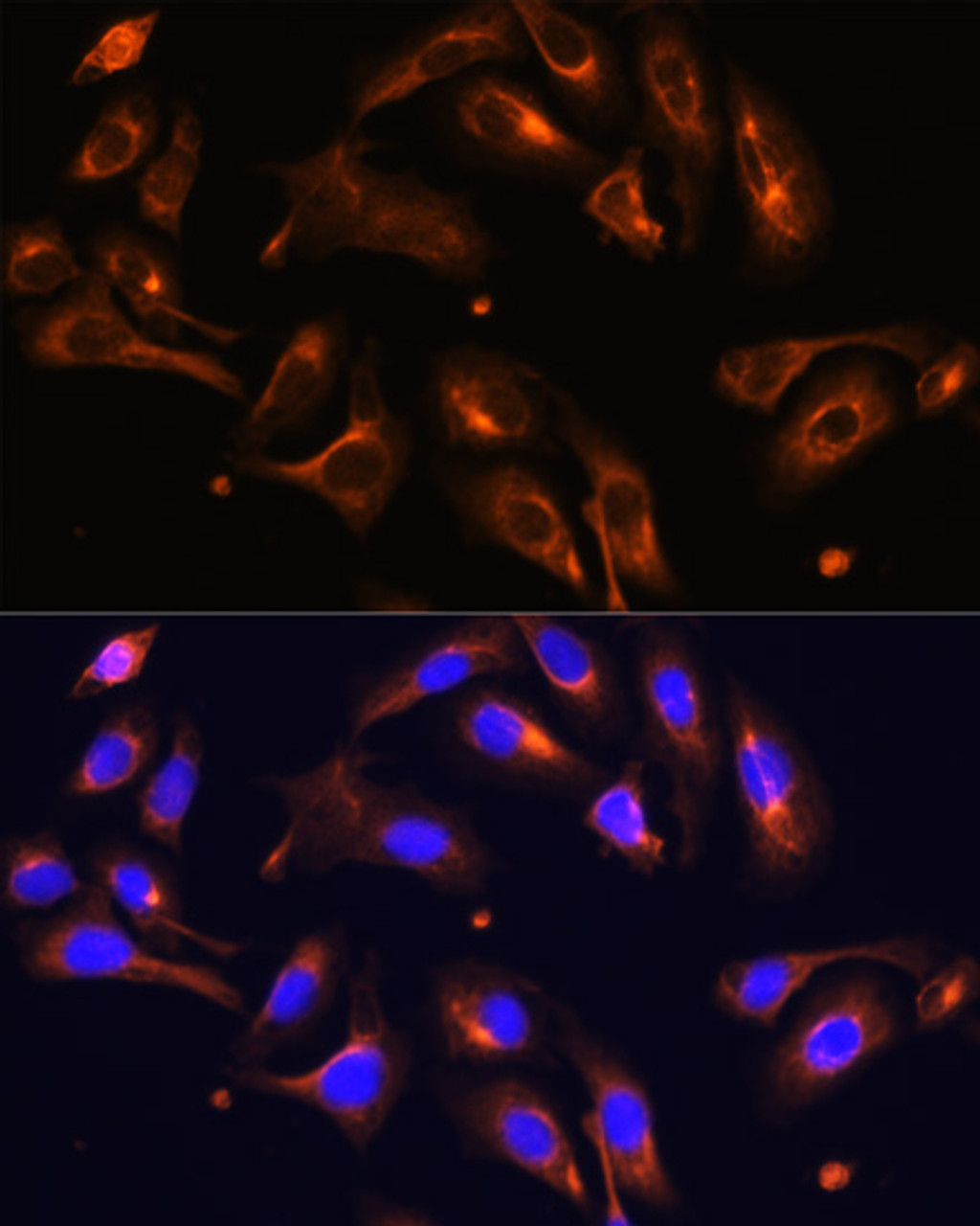 Immunofluorescence analysis of U-2 OS cells using MLPH Polyclonal Antibody at dilution of  1:100. Blue: DAPI for nuclear staining.