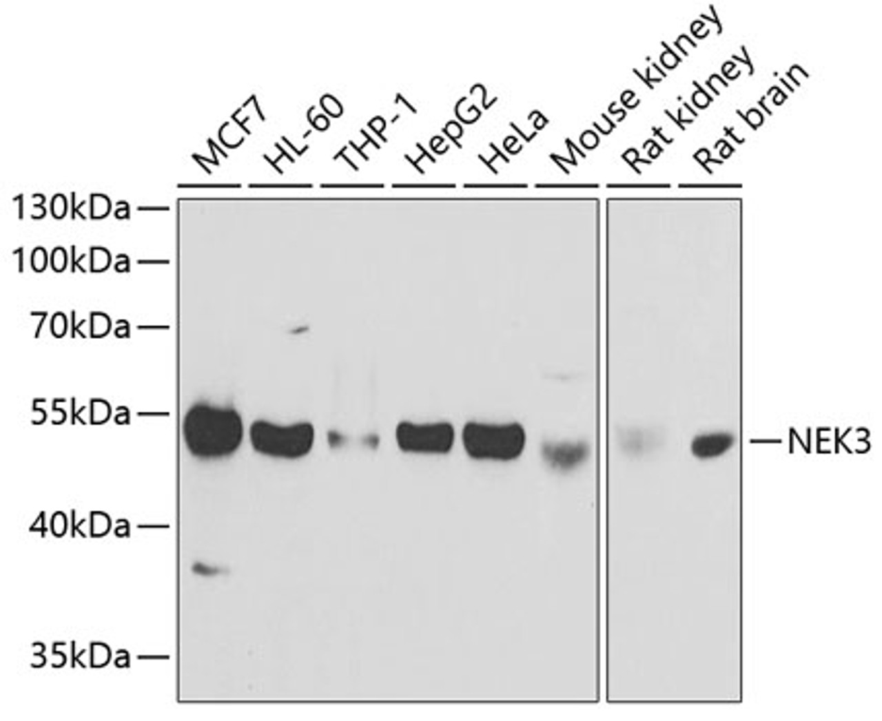 Western blot analysis of extracts of various cell lines using NEK3 Polyclonal Antibody at dilution of 1:1000.