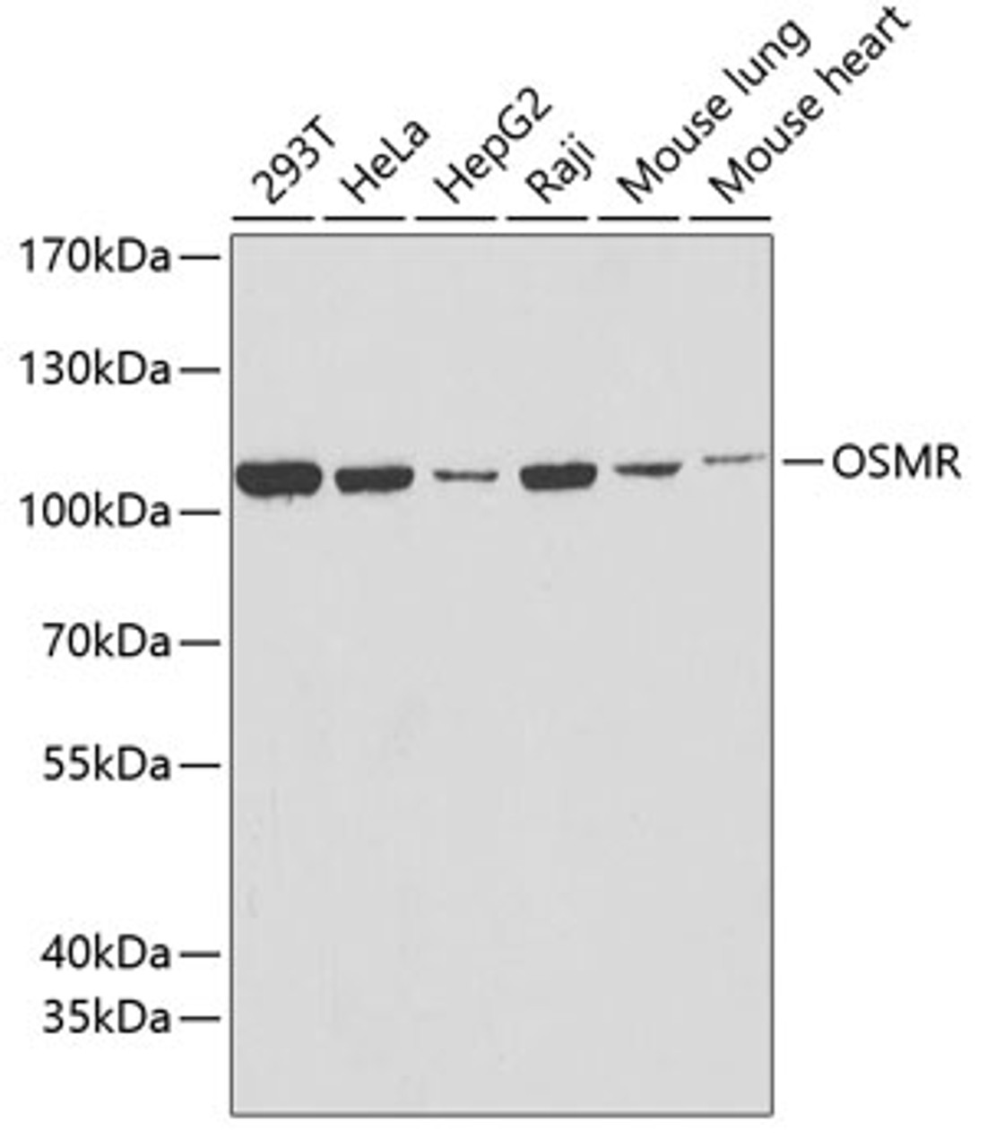 Western blot analysis of extracts of various cell lines using OSMR Polyclonal Antibody at dilution of 1:1000.