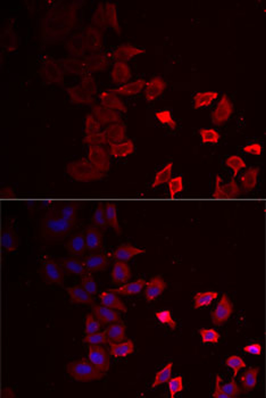 Immunofluorescence analysis of MCF7 cells using P2RX4 Polyclonal Antibody