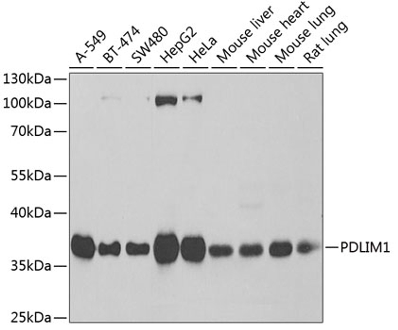 Western blot analysis of extracts of various cell lines using PDLIM1 Polyclonal Antibody at dilution of 1:1000.