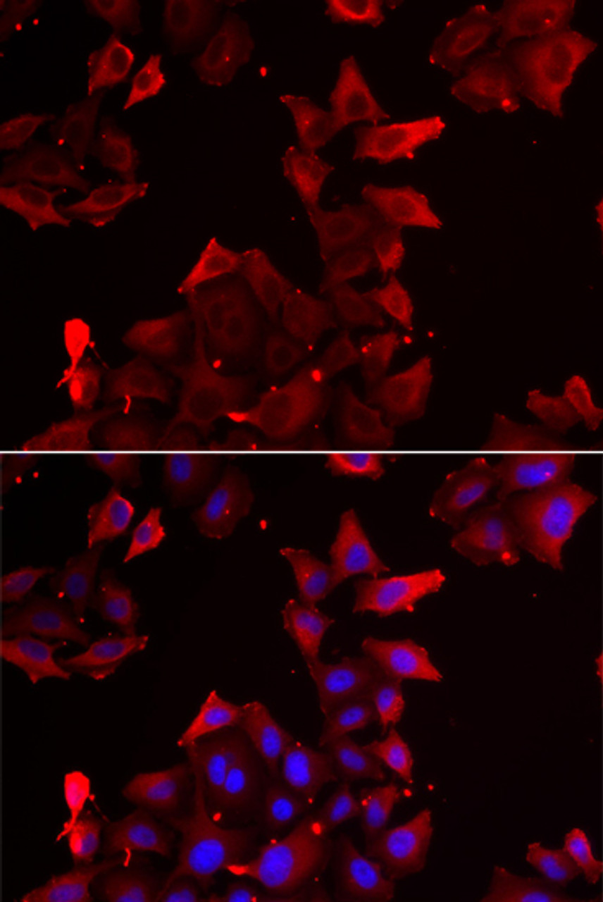 Immunofluorescence analysis of U2OS cells using PDLIM1 Polyclonal Antibody