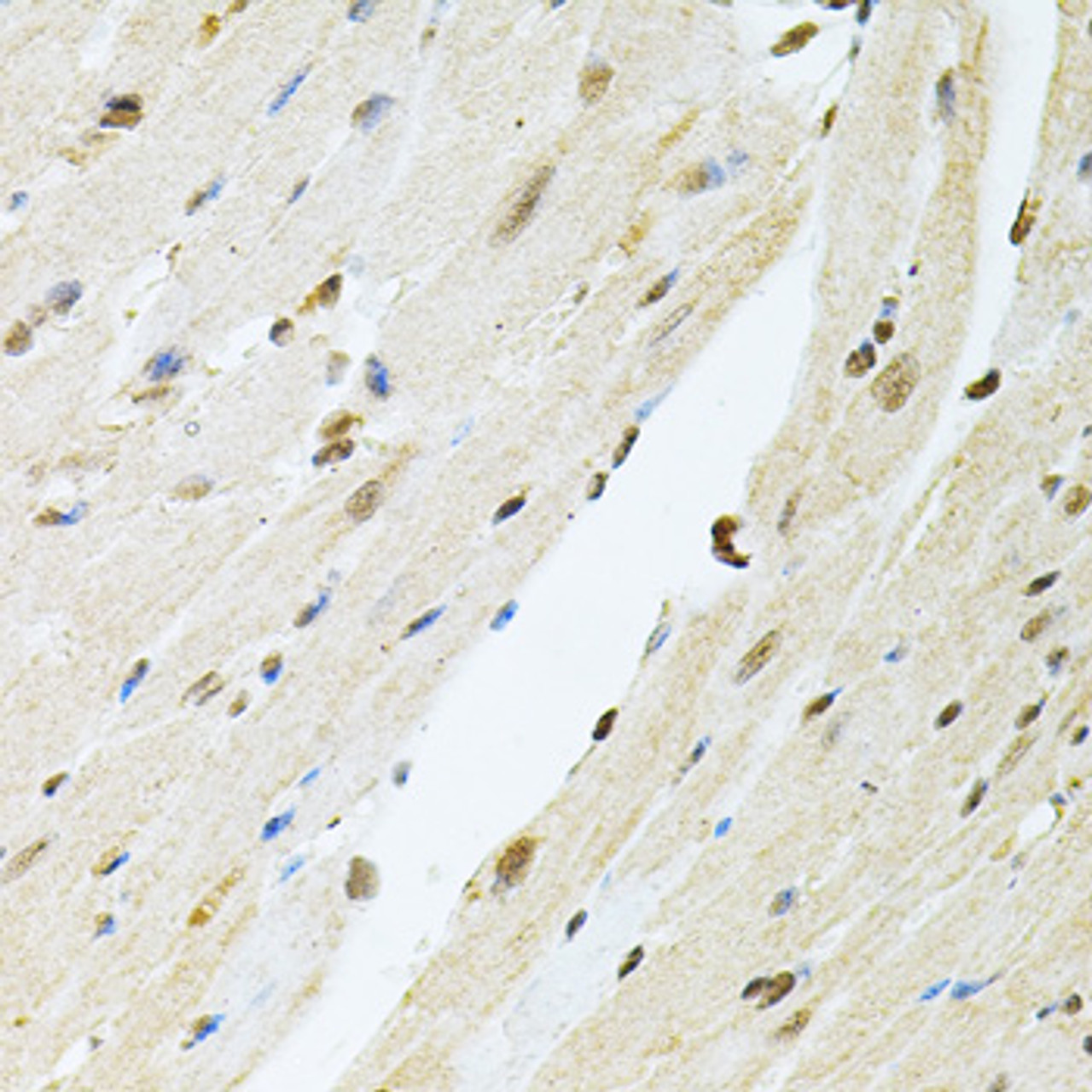 Immunohistochemistry of paraffin-embedded Mouse heart using PNKP Polyclonal Antibody at dilution of  1:100 (40x lens).