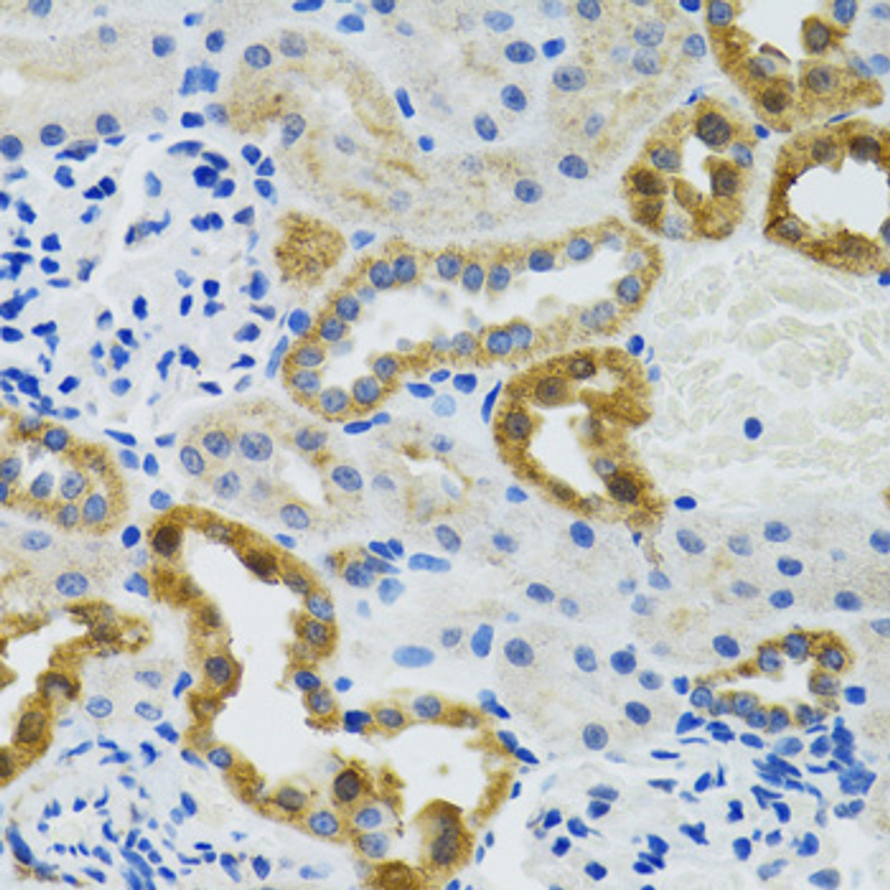 Immunohistochemistry of paraffin-embedded Mouse kidney using POLG2 Polyclonal Antibody at dilution of  1:100 (40x lens).
