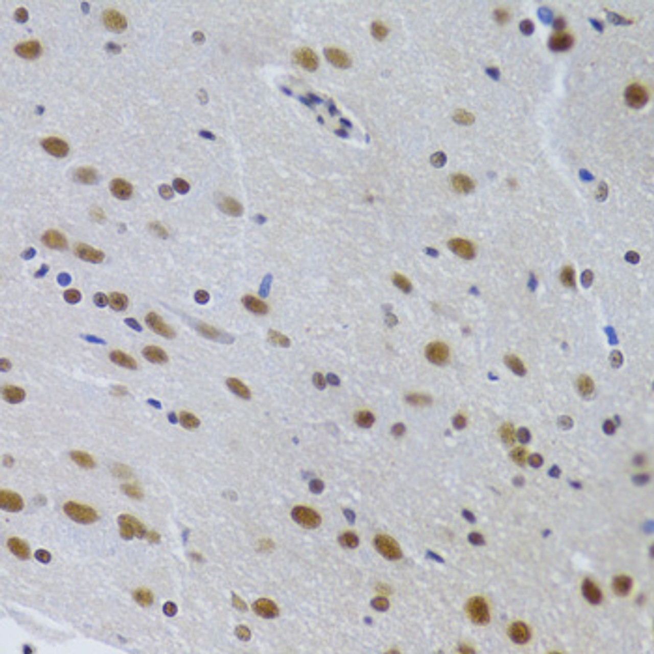 Immunohistochemistry of paraffin-embedded Rat brain using PPP1R8 Polyclonal Antibody at dilution of  1:100 (40x lens).