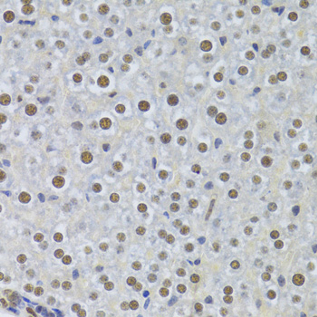Immunohistochemistry of paraffin-embedded Mouse liver using PPP1R8 Polyclonal Antibody at dilution of  1:100 (40x lens).