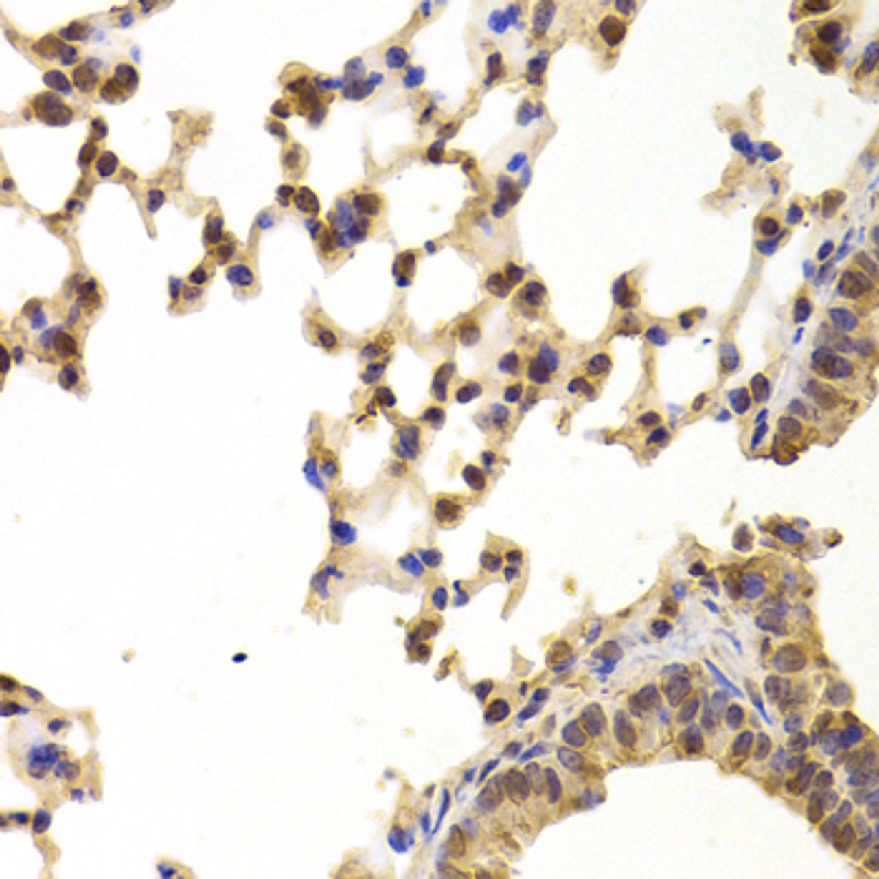 Immunohistochemistry of paraffin-embedded Mouse lung using PPP2R1B Polyclonal Antibody at dilution of  1:100 (40x lens).