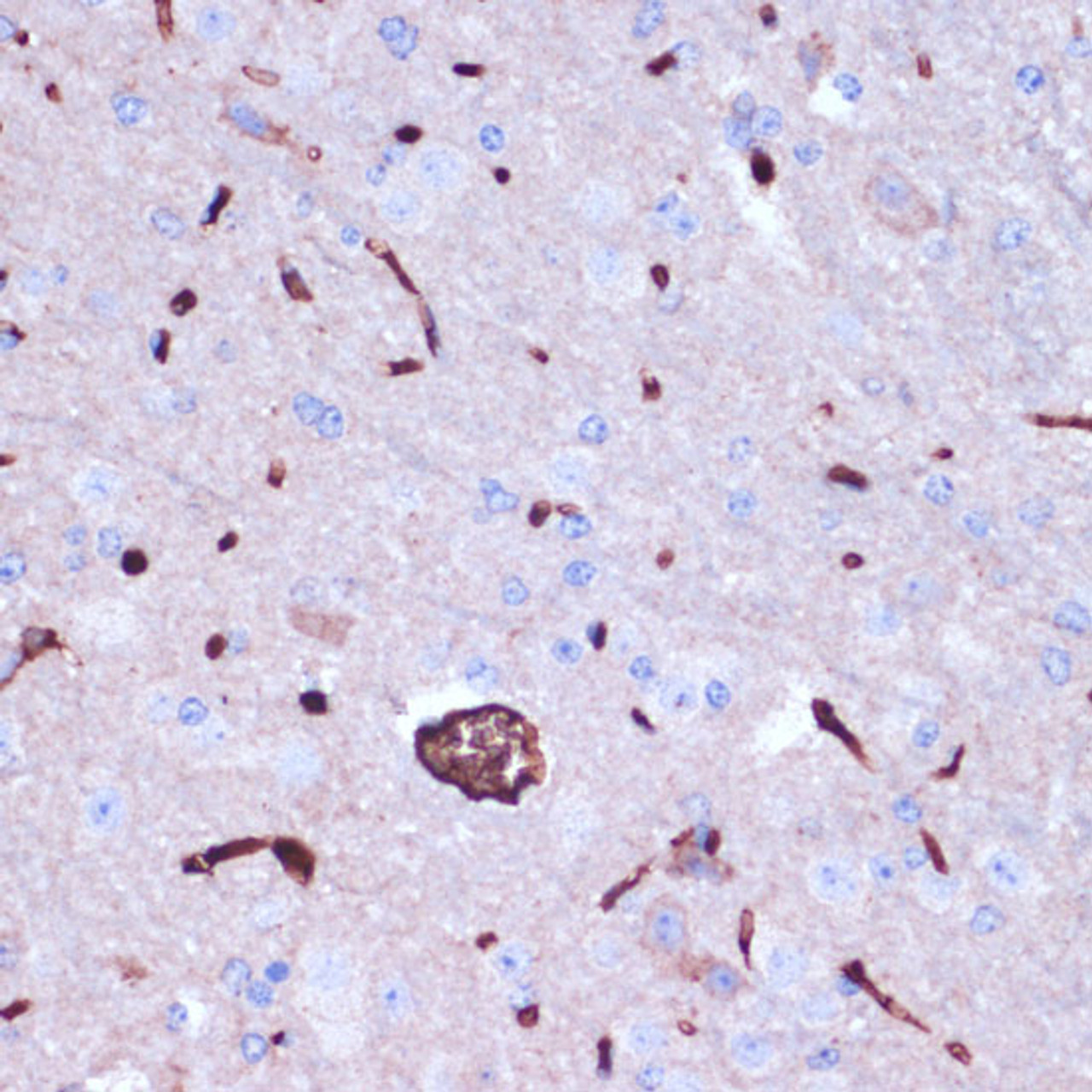 Immunohistochemistry of paraffin-embedded Mouse brain using PROK2 Polyclonal Antibody at dilution of  1:100 (40x lens).